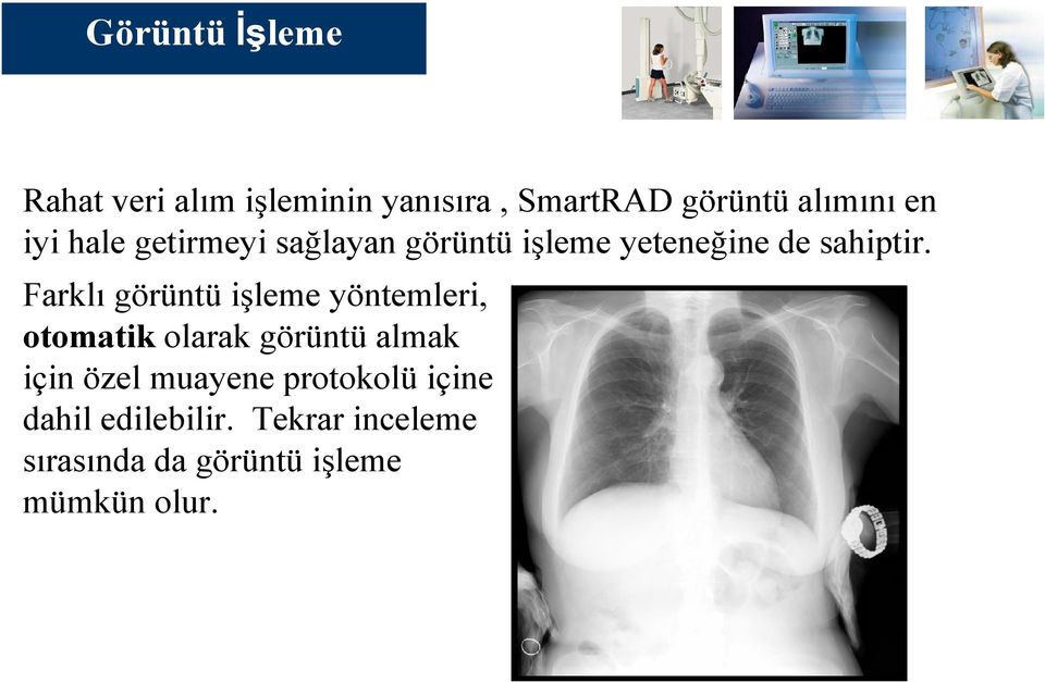 Farklı görüntü işleme yöntemleri, otomatik olarak görüntü almak için özel