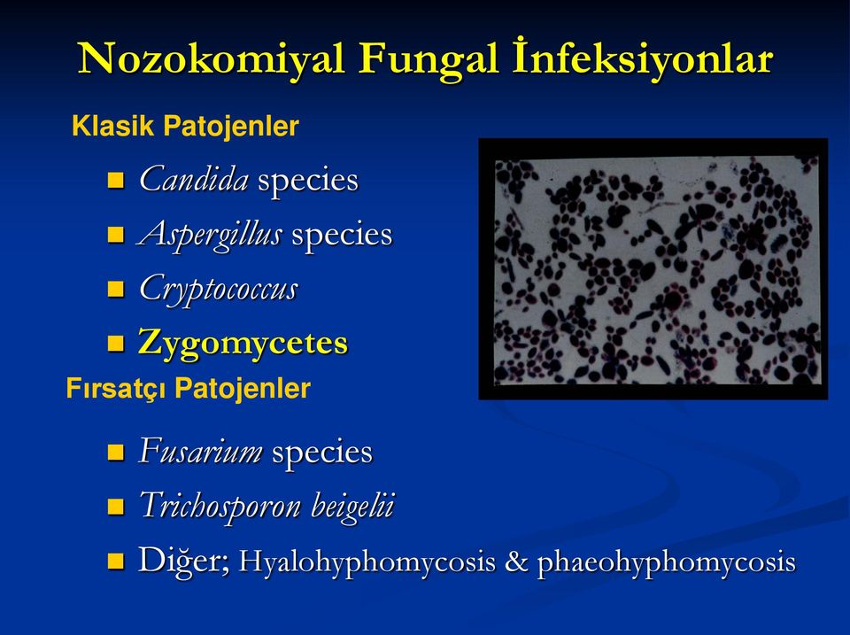 Zygomycetes Fırsatçı Patojenler Fusarium species