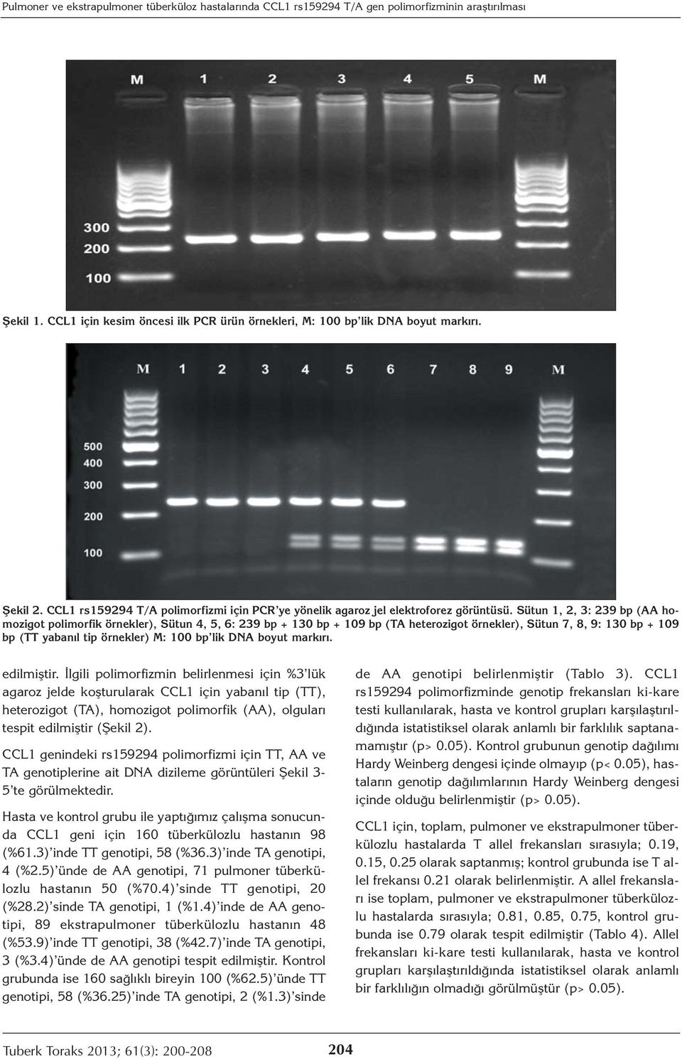 Sütun 1, 2, 3: 239 bp (AA homozigot polimorfik örnekler), Sütun 4, 5, 6: 239 bp + 130 bp + 109 bp (TA heterozigot örnekler), Sütun 7, 8, 9: 130 bp + 109 bp (TT yabanıl tip örnekler) M: 100 bp lik DNA