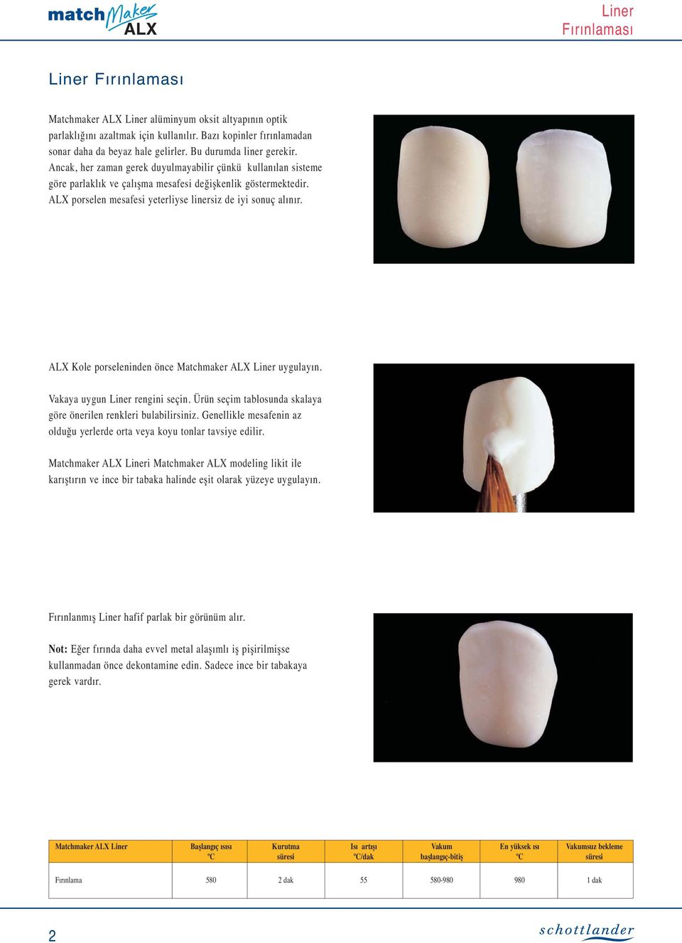 ALX porselen mesafesi yeterliyse linersiz de iyi sonuç alınır. ALX Kole porseleninden önce Matchmaker ALX Liner uygulayın. Vakaya uygun Liner rengini seçin.