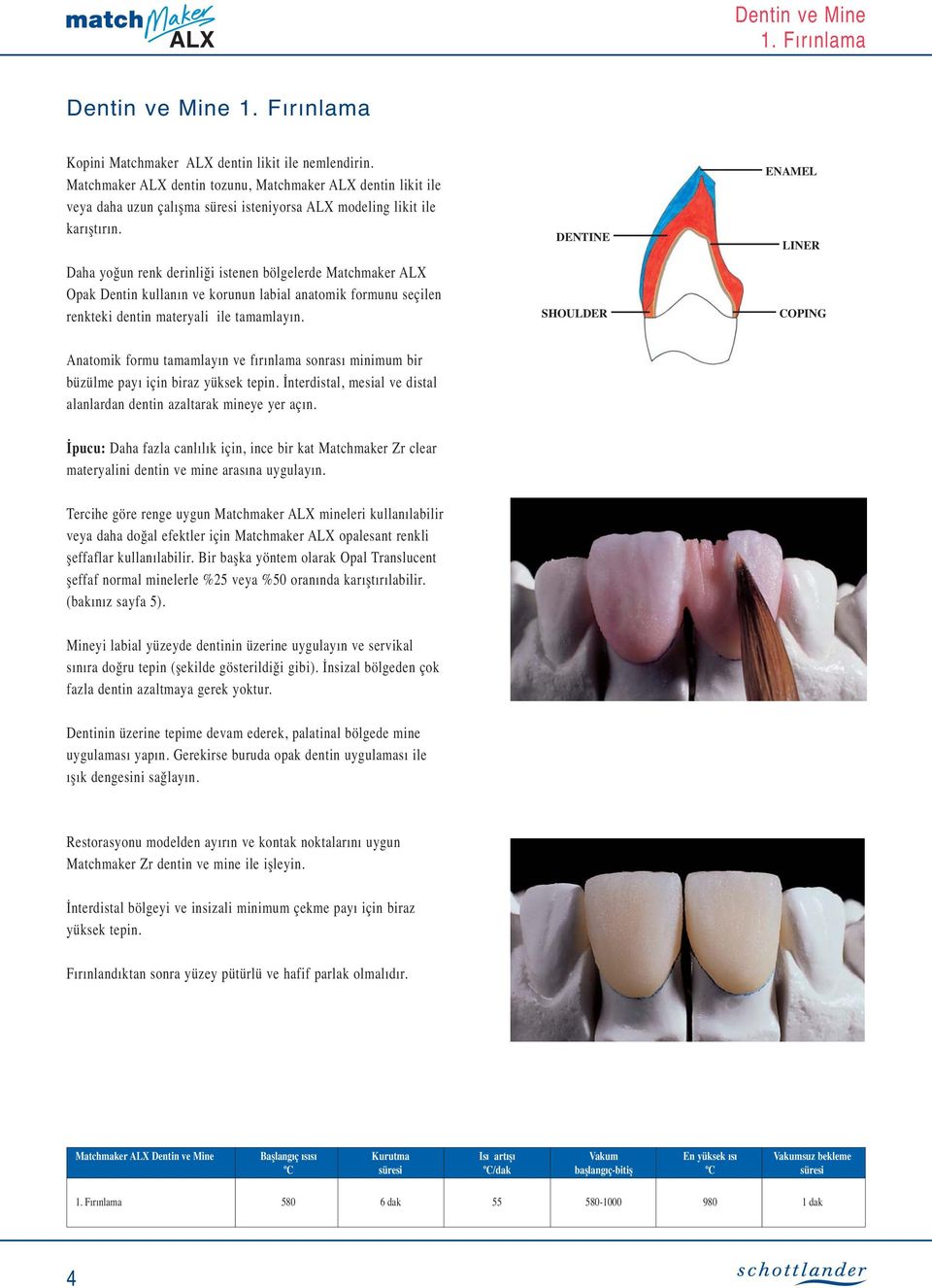 Daha yoğun renk derinliği istenen bölgelerde Matchmaker ALX Opak Dentin kullanın ve korunun labial anatomik formunu seçilen renkteki dentin materyali ile tamamlayın.