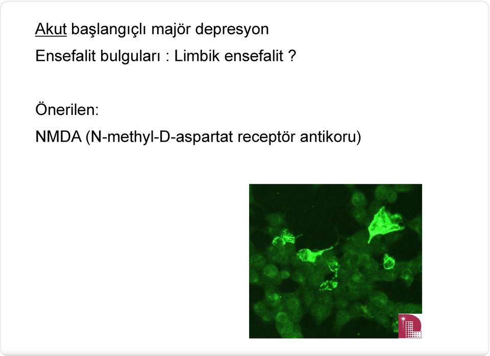 Limbik ensefalit?