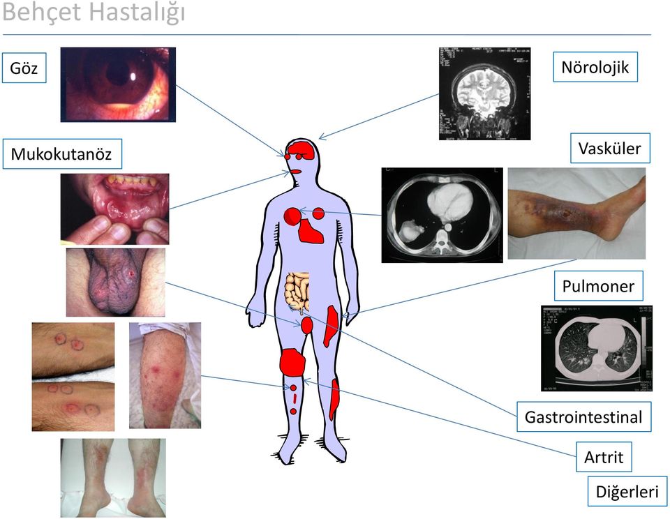 Vasküler Pulmoner