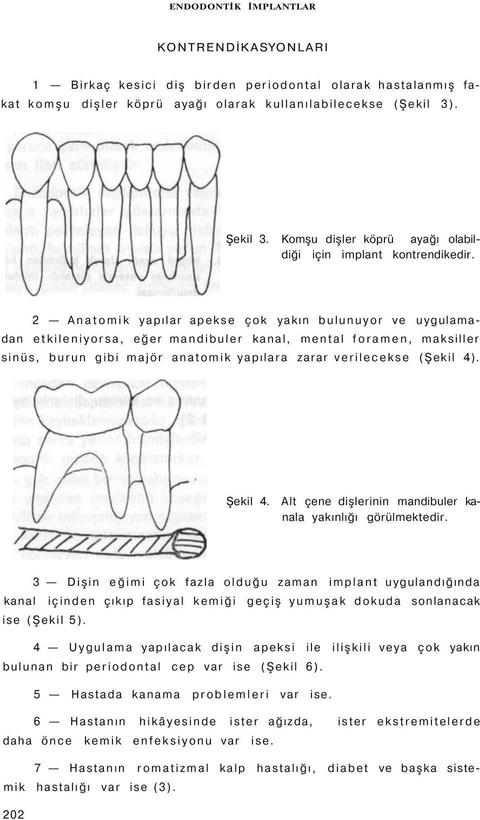 2 Anatomik yapılar apekse çok yakın bulunuyor ve uygulamadan etkileniyorsa, eğer mandibuler kanal, mental foramen, maksiller sinüs, burun gibi majör anatomik yapılara zarar verilecekse (Şekil 4).