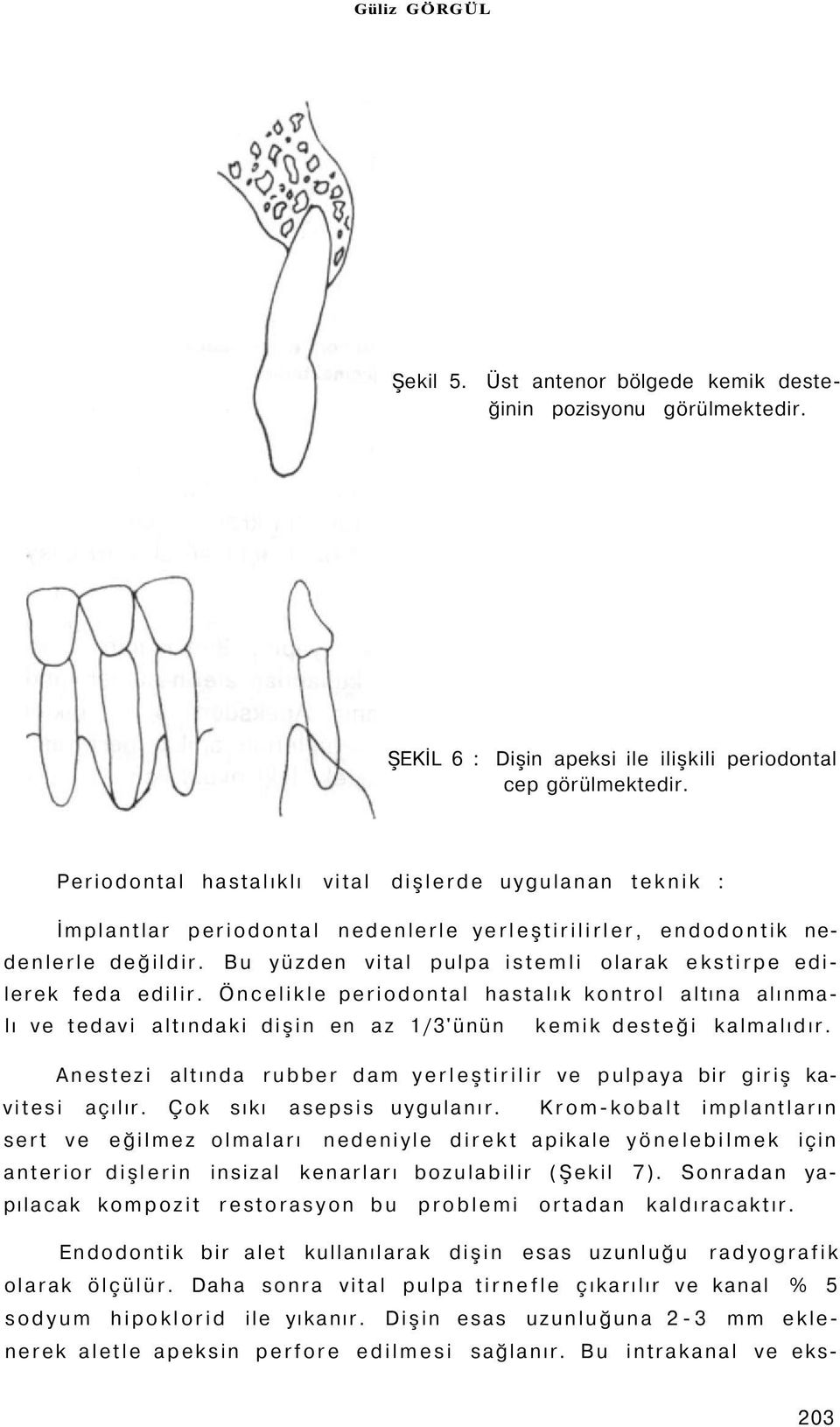 Bu yüzden vital pulpa istemli olarak ekstirpe edilerek feda edilir. Öncelikle periodontal hastalık kontrol altına alınmalı ve tedavi altındaki dişin en az 1/3'ünün kemik desteği kalmalıdır.