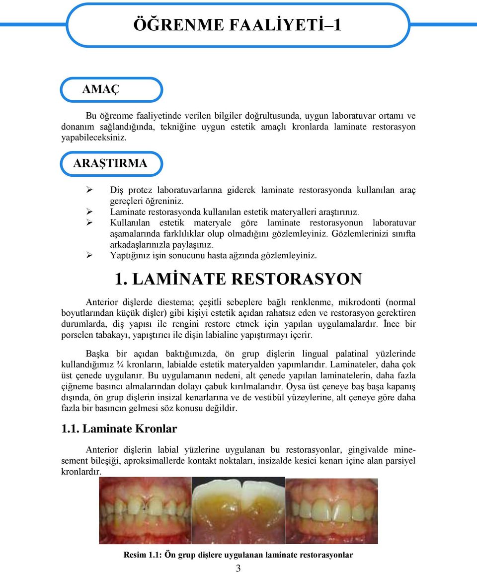 Laminate restorasyonda kullanılan estetik materyalleri araģtırınız. Kullanılan estetik materyale göre laminate restorasyonun laboratuvar aģamalarında farklılıklar olup olmadığını gözlemleyiniz.