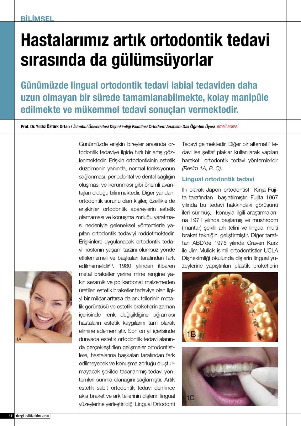 Yıldız Öztürk Ortan / İstanbul Üniversitesi Dişhekimliği Fakültesi Ortodonti Anabilim Dalı Öğretim Üyesi email adresi Günümüzde erişkin bireyler arasında ortodontik tedaviye ilgide hızlı bir artış