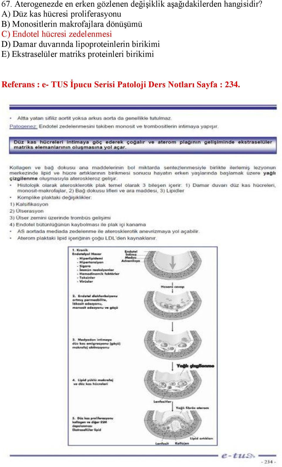 hücresi zedelenmesi D) Damar duvarında lipoproteinlerin birikimi E) Ekstraselüler