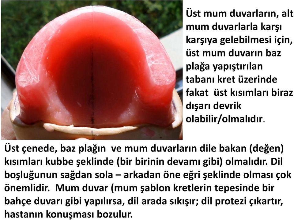 Üst çenede, baz plağın ve mum duvarların dile bakan (değen) kısımları kubbe şeklinde (bir birinin devamı gibi) olmalıdır.