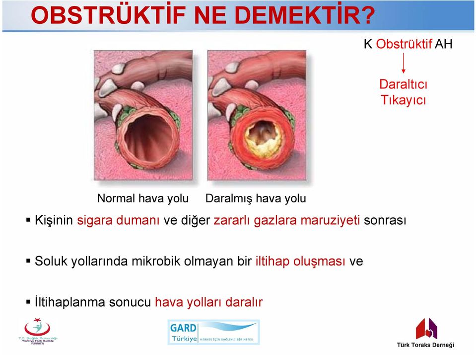 yolu Kişinin sigara dumanı ve diğer zararlı gazlara maruziyeti