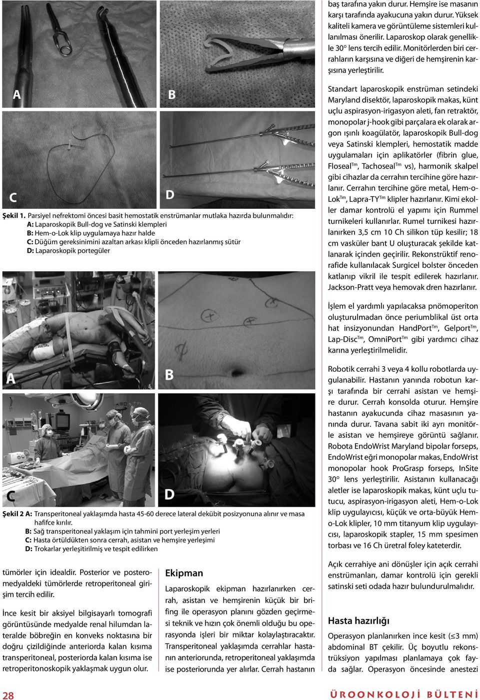 Parsiyel nefrektomi öncesi basit hemostatik enstrümanlar mutlaka hazırda bulunmalıdır: A: Laparoskopik Bull-dog ve Satinski klempleri B: Hem-o-Lok klip uygulamaya hazır halde C: Düğüm gereksinimini