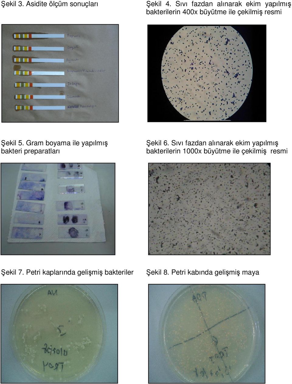 Gram boyama ile yapılmış bakteri preparatları Şekil 6.