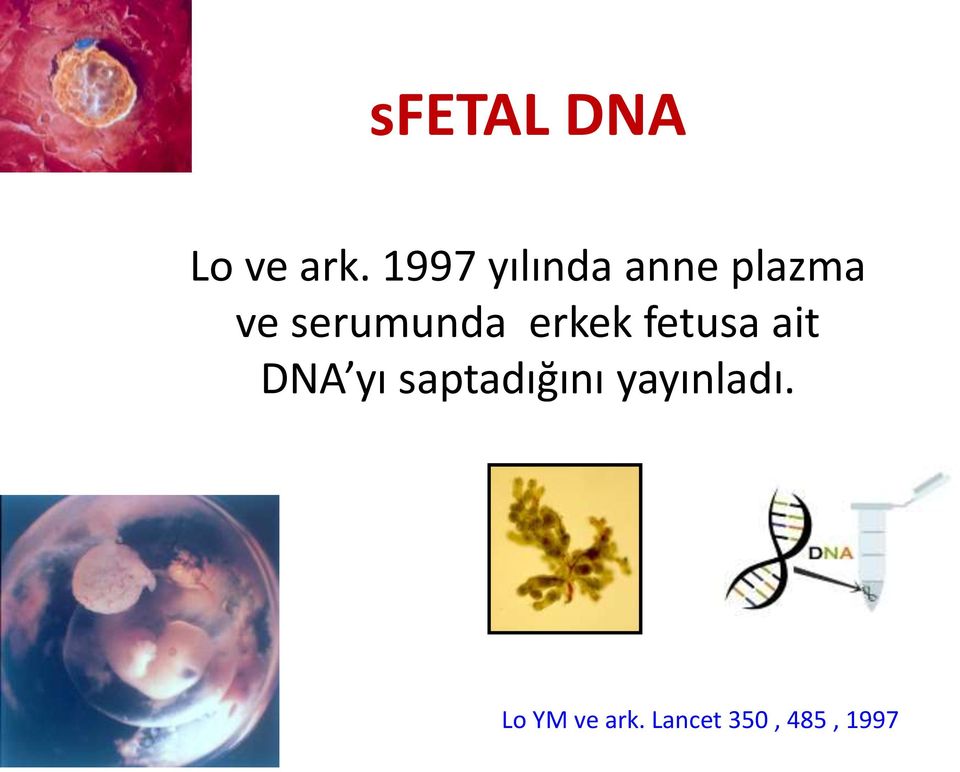 serumunda erkek fetusa ait DNA yı