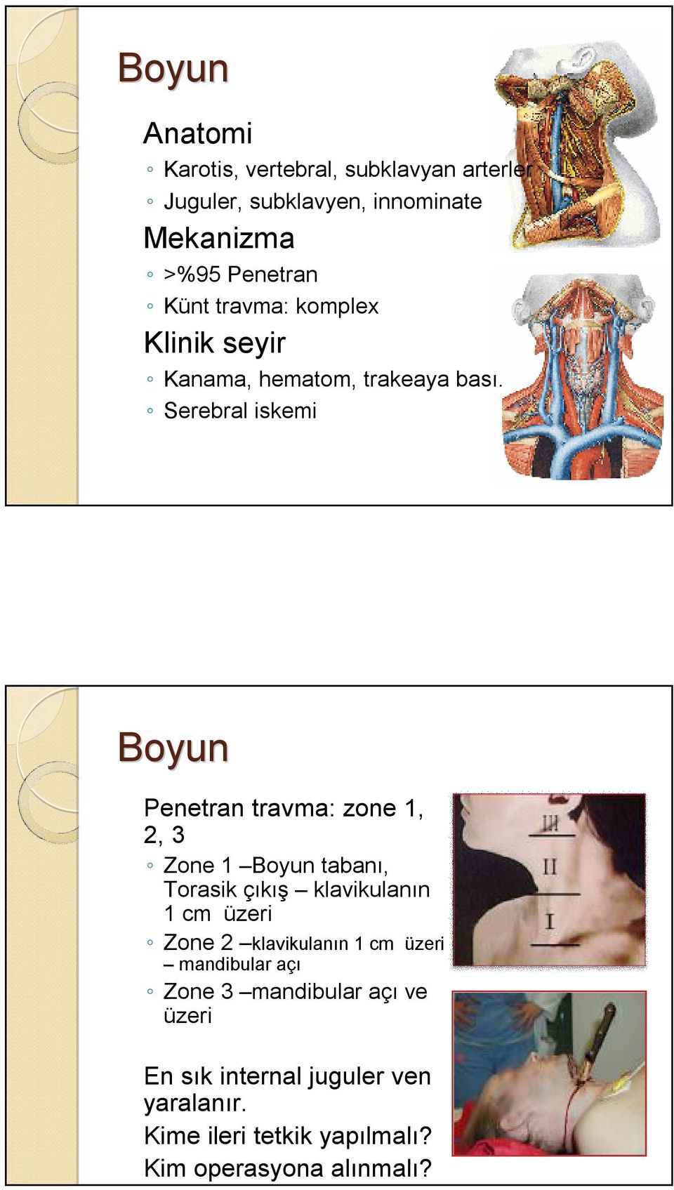 Serebral iskemi Boyun Penetran travma: zone 1, 2, 3 Zone 1 Boyun tabanı, Torasik çıkış klavikulanın 1 cm üzeri