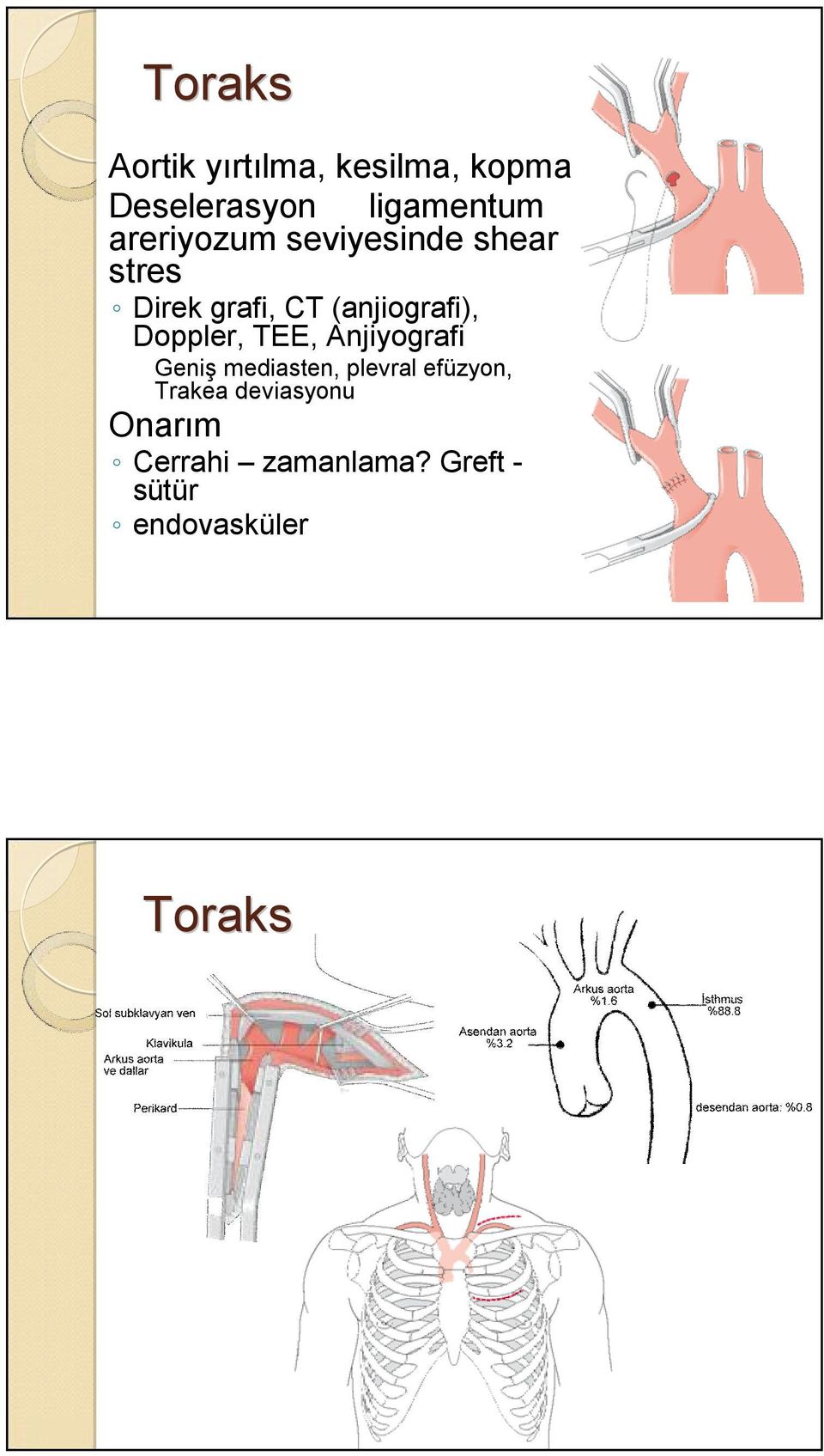 Doppler, TEE, Anjiyografi Geniş mediasten, plevral efüzyon,