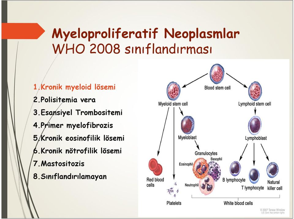 Esansiyel Trombositemi 4.Primer myelofibrozis 5.