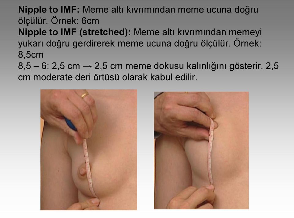 doğru gerdirerek meme ucuna doğru ölçülür.