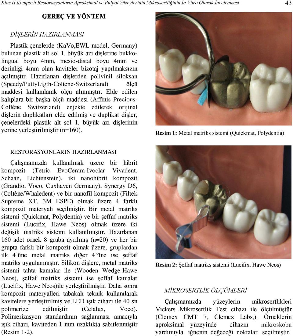 Hazırlanan dişlerden polivinil siloksan (Speedy/PuttyLigth-Coltene-Switzerland) ölçü maddesi kullanılarak ölçü alınmıştır.