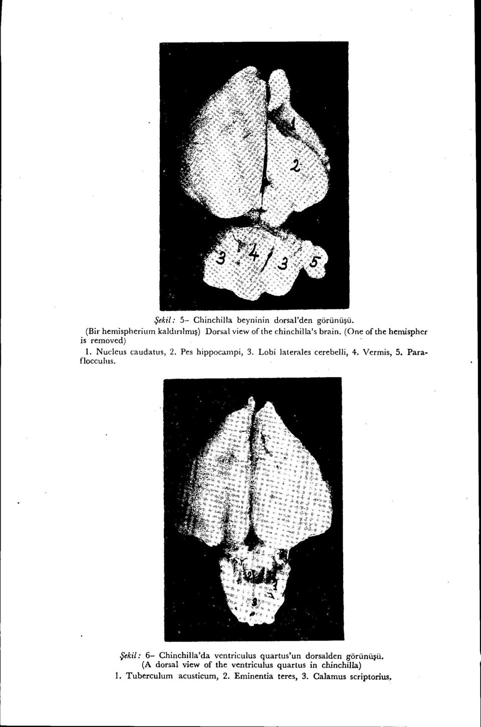 Nuclcus caudatııs, 2. Pes hippocaınpi, 3. Lobi laterales cerebelli, 4. Vermis, 5. Parafloccuhıs.