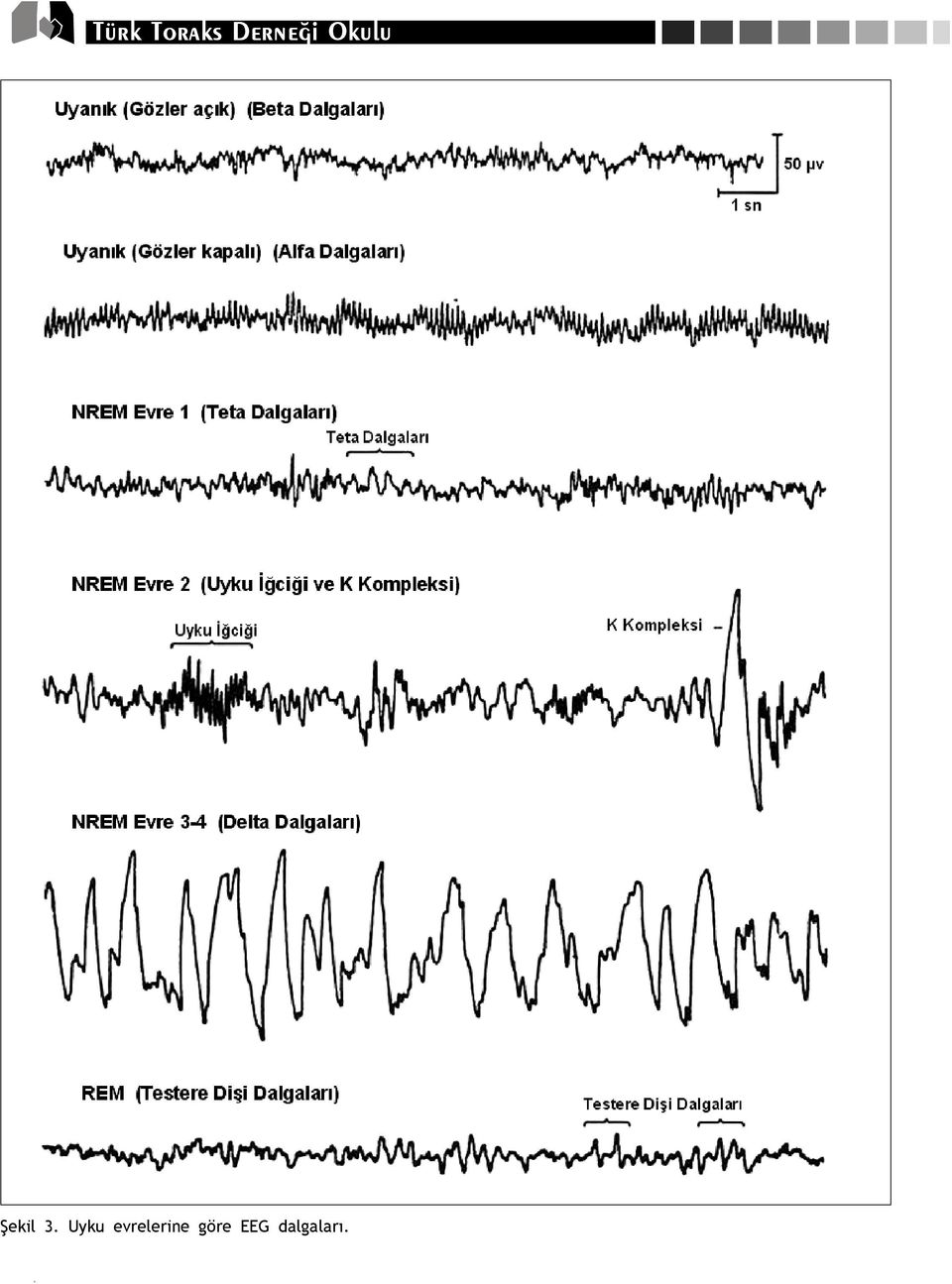 Polisomnografide EEG, EOG ve EMG Kay d : Temel Bilgiler - PDF Ücretsiz  indirin