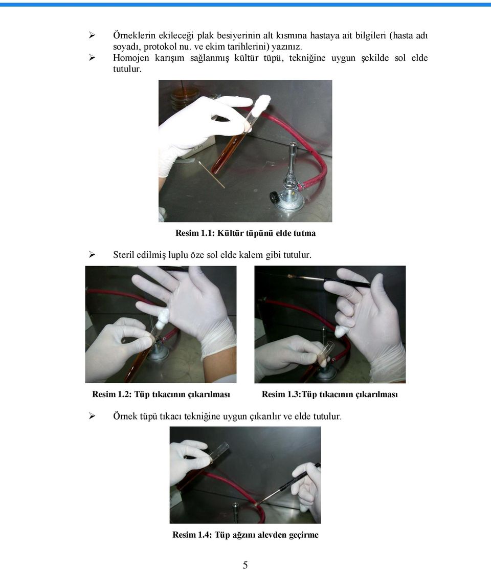 1: Kültür tüpünü elde tutma Steril edilmiģ luplu öze sol elde kalem gibi tutulur. Resim 1.