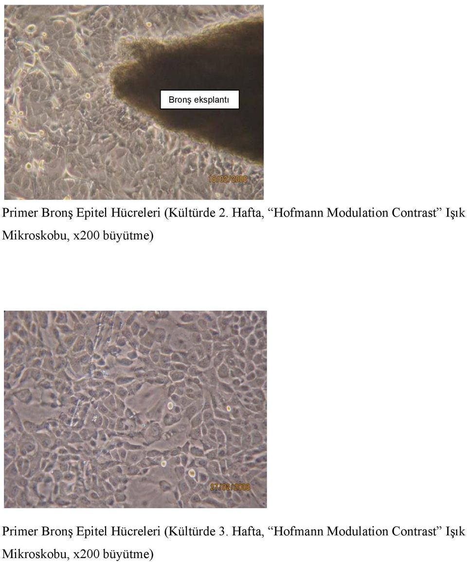büyütme) Primer Bronş Epitel Hücreleri (Kültürde 3.