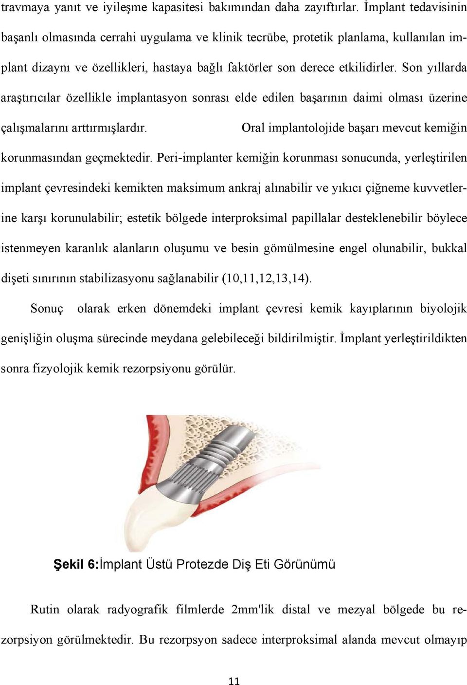 Son yıllarda araştırıcılar özellikle implantasyon sonrası elde edilen başarının daimi olması üzerine çalışmalarını arttırmışlardır. Oral implantolojide başarı mevcut kemiğin korunmasından geçmektedir.