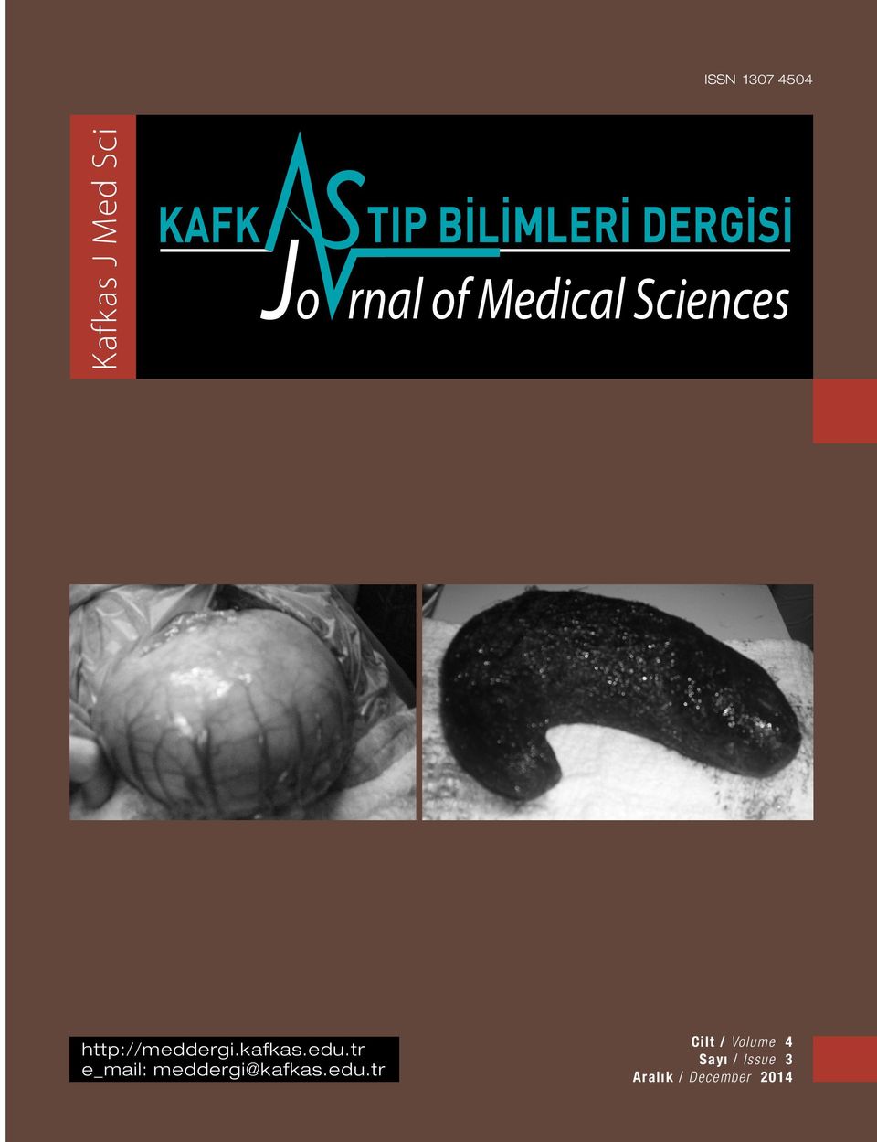 65365 Kafkas Tıp Bilimleri Dergisi İçindekiler / Contents Seroprevalence of Hepatitis B and Hepatitis C: A Community Based Study Conducted in İzmir, Turkey.