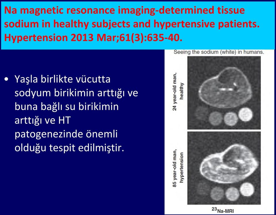 Hypertension 2013 Mar;61(3):635-40.