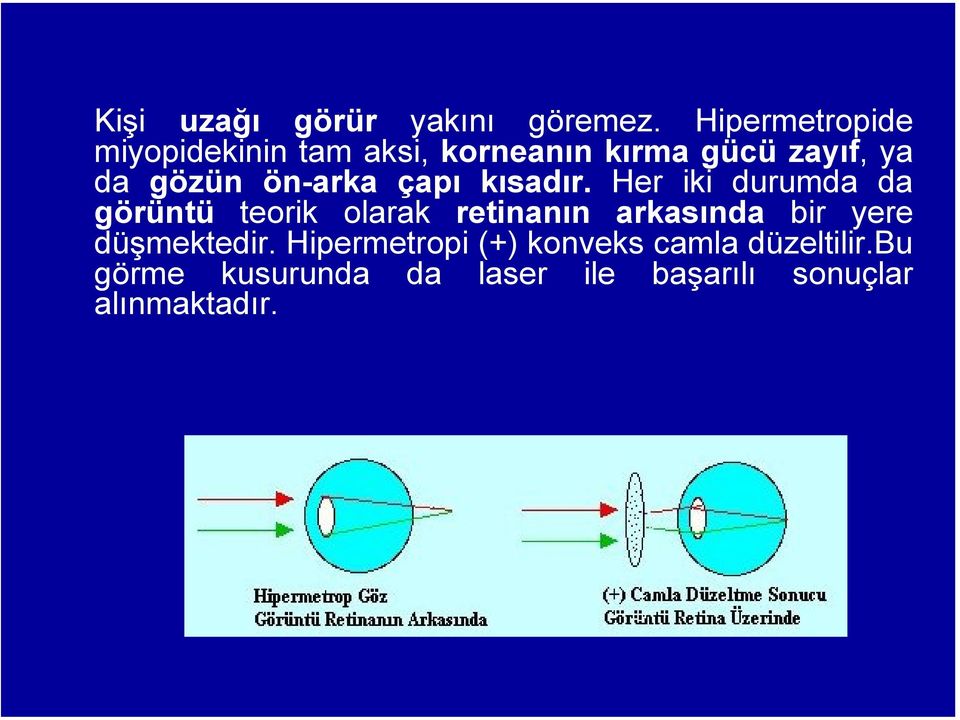 ön-arka çapı kısadır.