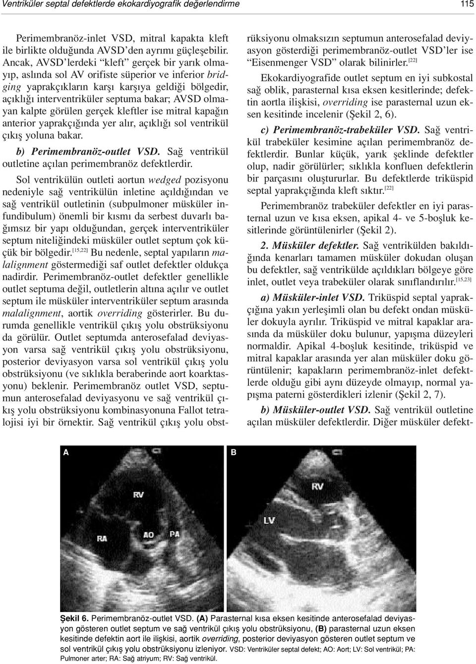 olmayan kalpte görülen gerçek kleftler ise mitral kapa n anterior yaprakç nda yer al r, aç kl sol ventrikül ç k fl yoluna bakar. b) Perimembranöz-outlet VSD.
