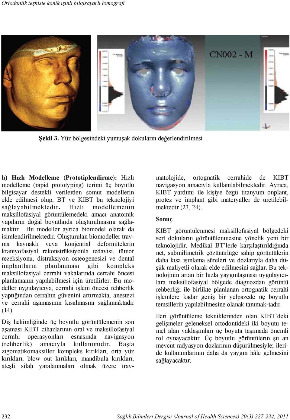 edilmesi olup, BT ve KIBT bu teknolojiyi sağlayabilmektedir. Hızlı modellemenin maksillofasiyal görüntülemedeki amacı anatomik yapıların doğal boyutlarda oluşturulmasını sağlamaktır.