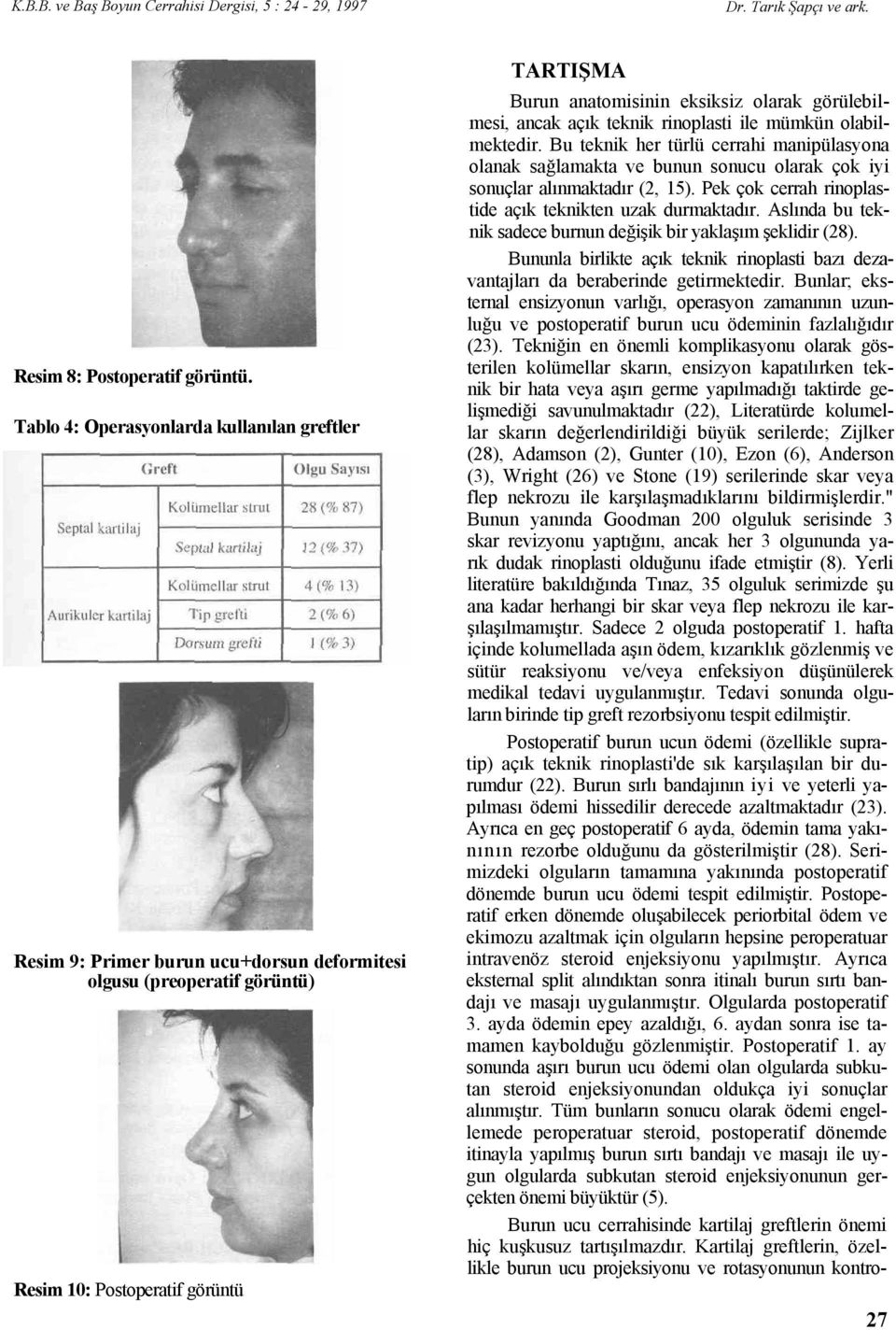 görülebilmesi, ancak açık teknik rinoplasti ile mümkün olabilmektedir. Bu teknik her türlü cerrahi manipülasyona olanak sağlamakta ve bunun sonucu olarak çok iyi sonuçlar alınmaktadır (2, 15).