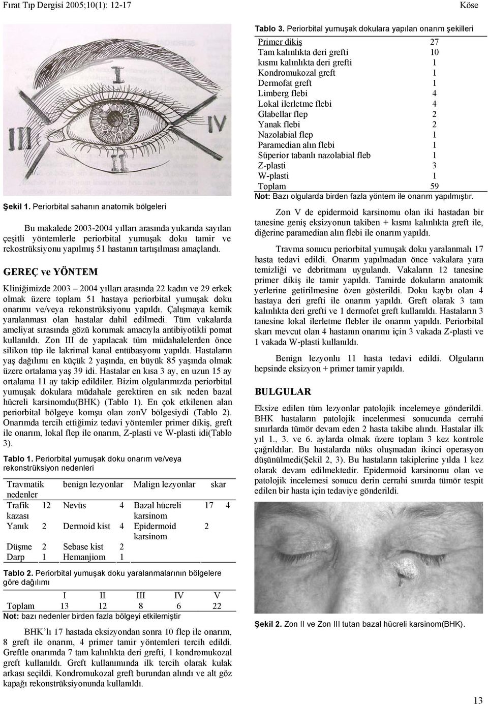 amaçlandı. GEREÇ ve YÖNTEM Kliniğimizde 2003 2004 yılları arasında 22 kadın ve 29 erkek olmak üzere toplam 51 hastaya periorbital yumuşak doku onarımı ve/veya rekonstrüksiyonu yapıldı.