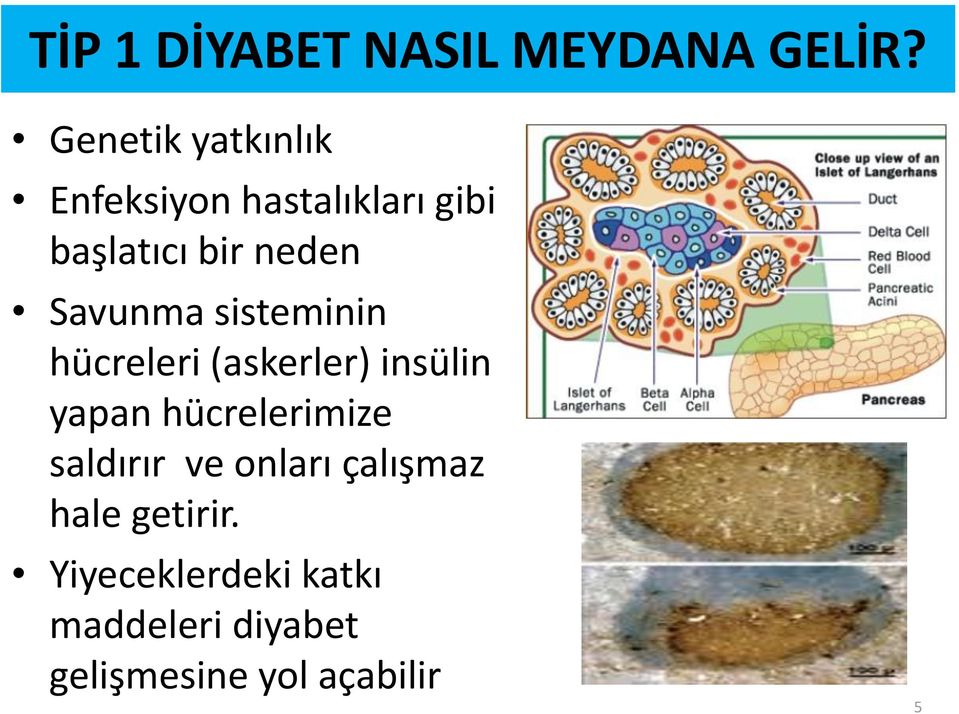 Savunma sisteminin hücreleri (askerler) insülin yapan hücrelerimize