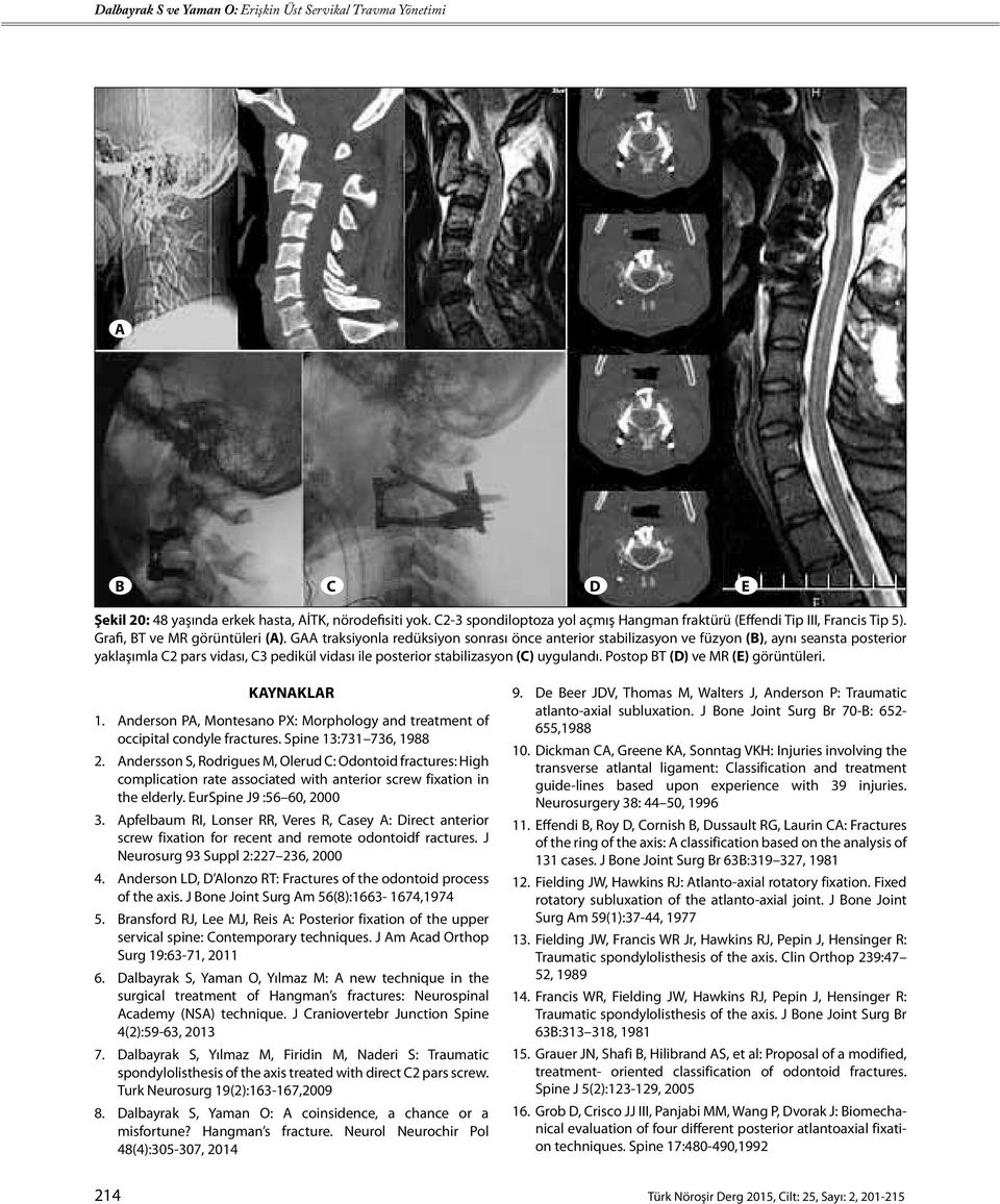Postop BT (D) ve MR (E) görüntüleri. KAYNAKLAR 1. Anderson PA, Montesano PX: Morphology and treatment of occipital condyle fractures. Spine 13:731 736, 1988 2.