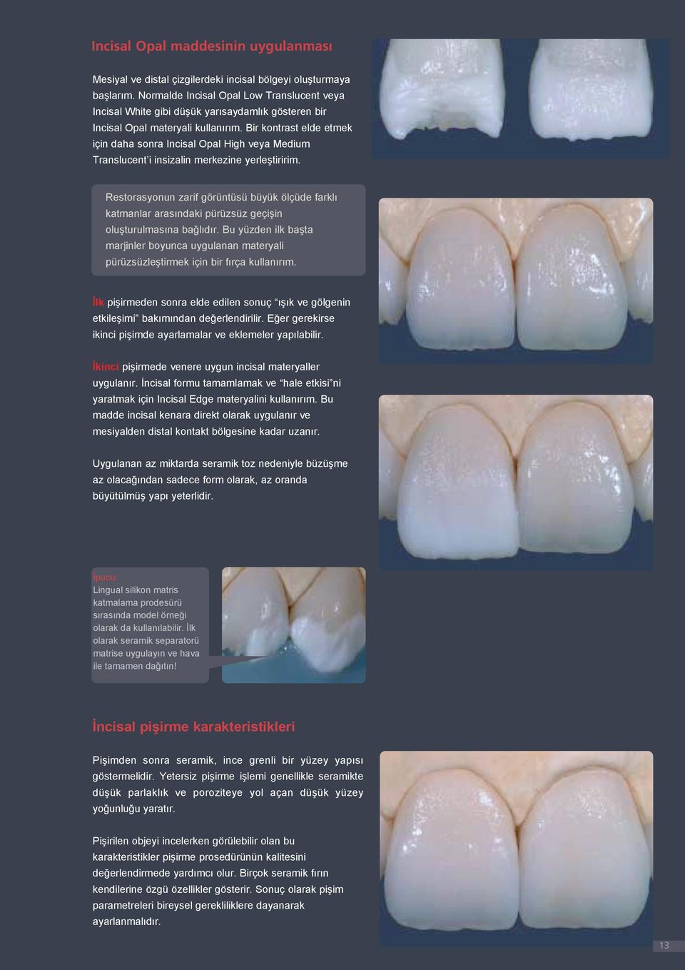 Bir kontrast elde etmek için daha sonra Incisal Opal High veya Medium Translucent i insizalin merkezine yerleştiririm.