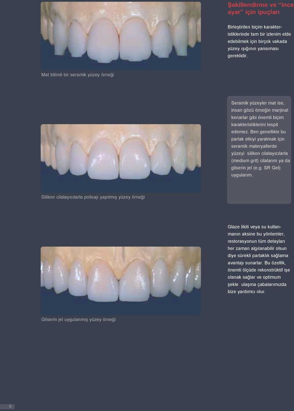 Ben genellikle bu parlak etkiyi yaratmak için seramik materyallerde yüzeyi silikon cilalayıcılarla (medium grit) cilalarım ya da gliserin jel (e.g. SR Gel) uygularım.