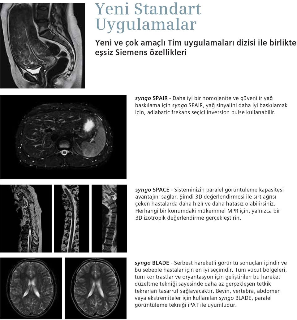 Şimdi 3D değerlendirmesi ile sırt ağrısı çeken hastalarda daha hızlı ve daha hatasız olabilirsiniz. Herhangi bir konumdaki mükemmel MPR için, yalnızca bir 3D izotropik değerlendirme gerçekleştirin.