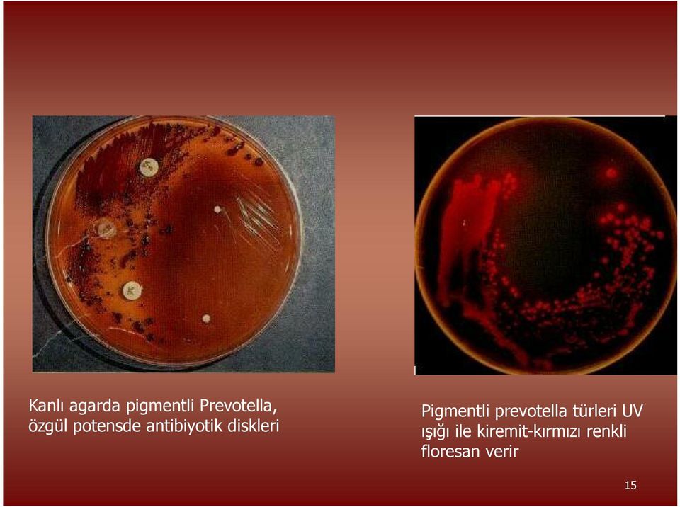 Pigmentli prevotella türleri UV ışığı