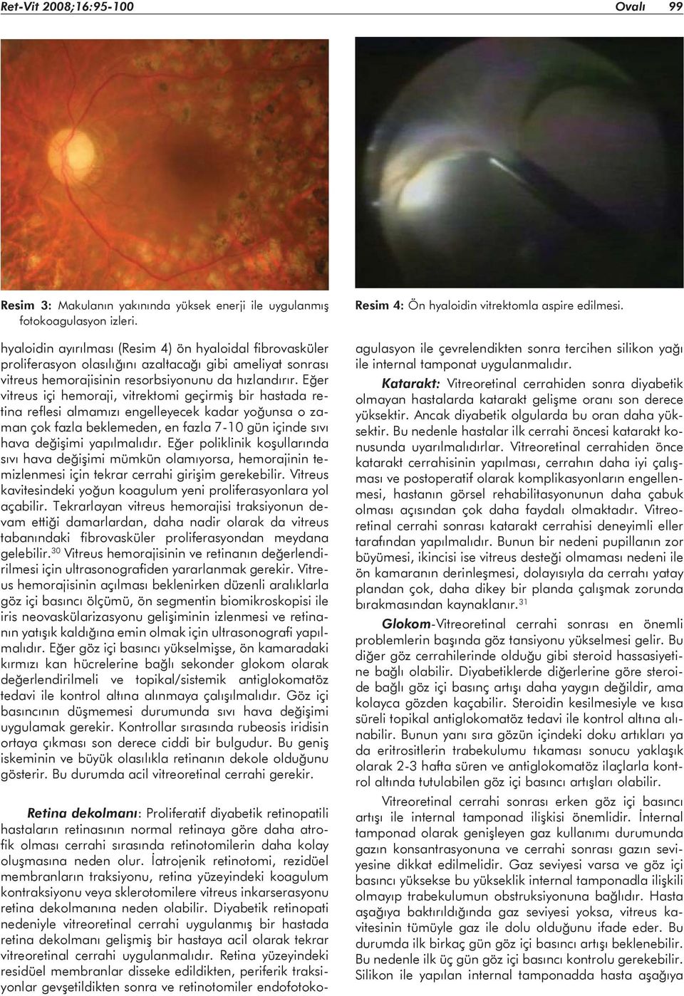 Eğer vitreus içi hemoraji, vitrektomi geçirmiş bir hastada retina reflesi almamızı engelleyecek kadar yoğunsa o zaman çok fazla beklemeden, en fazla 7-10 gün içinde sıvı hava değişimi yapılmalıdır.