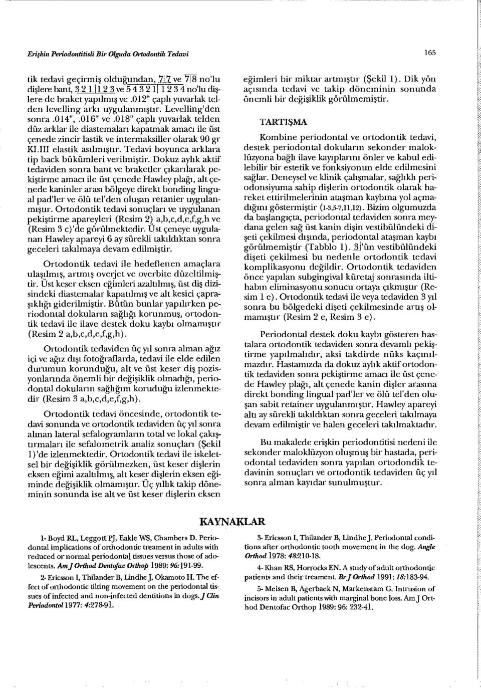 018" çaplı yuvarlak telden düz arklar ile diastemalan kapatmak amacı ile üst çenede zincir lastik ve intermaksiller olarak 90 gr KI.III elastik asılmıştır.