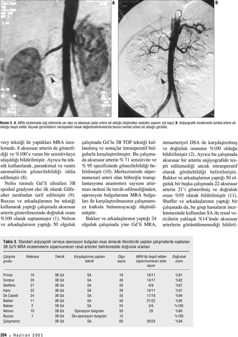 very tekniği ile yapt klar MRA incelemede, 8 aksesuar arterin de gösterildiği ve %100 e varan bir sensitiviteye ulaş ld ğ bildirilmiştir.