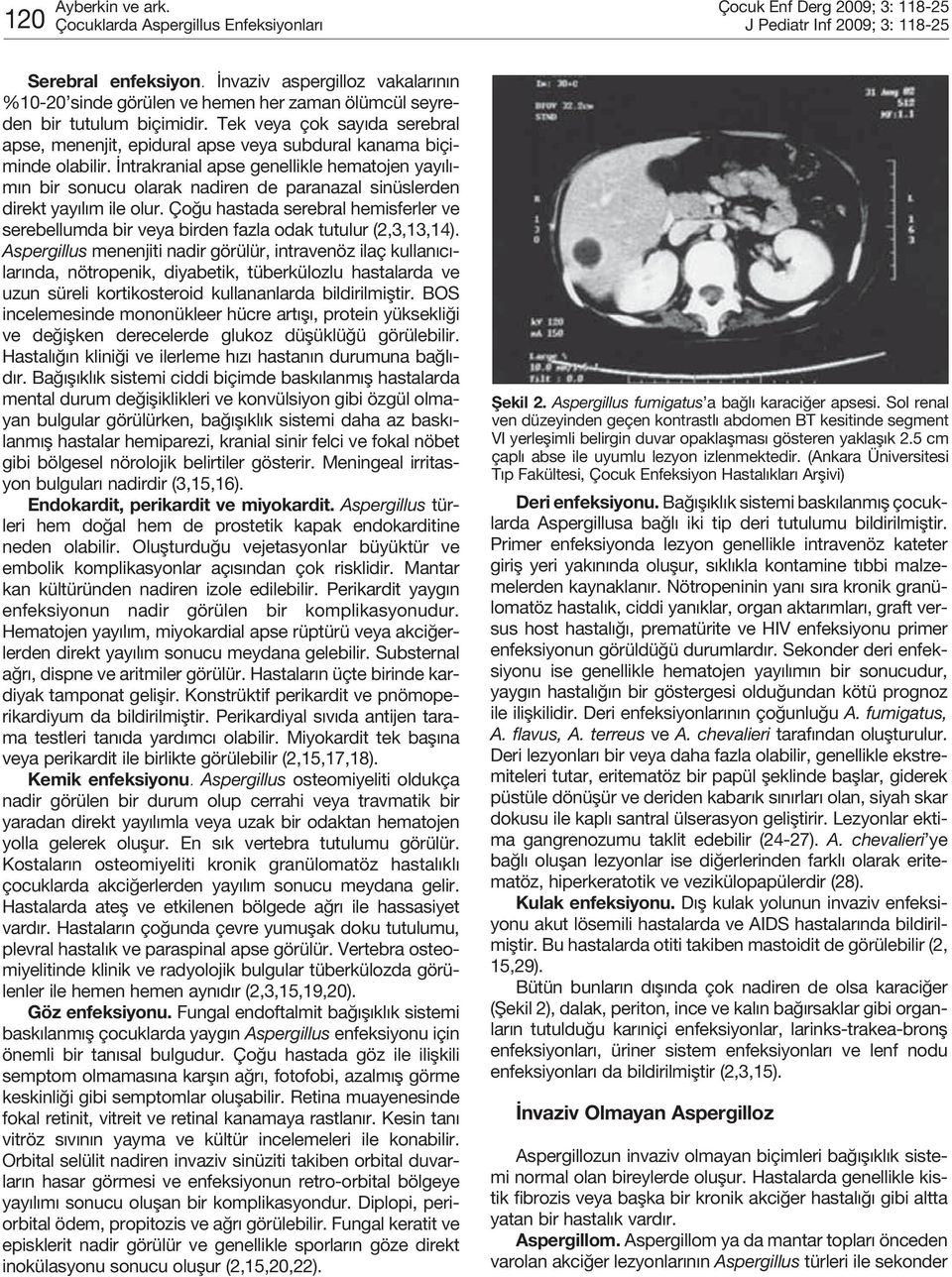 Tek veya çok sayıda serebral apse, menenjit, epidural apse veya subdural kanama biçiminde olabilir.