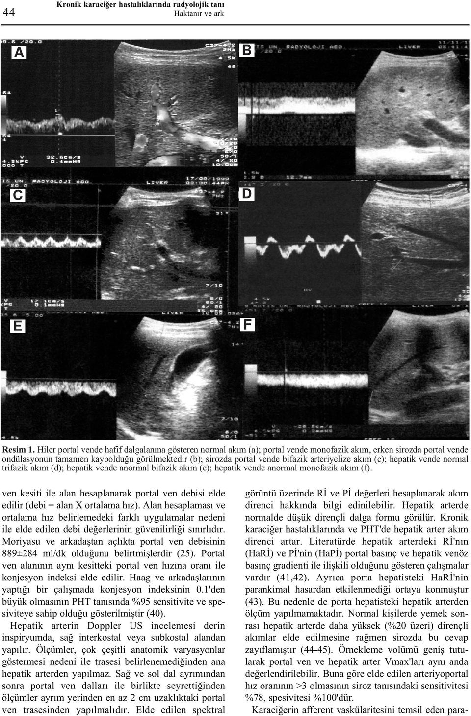 arteriyelize akým (c); hepatik vende normal trifazik akým (d); hepatik vende anormal bifazik akým (e); hepatik vende anormal monofazik akým (f).