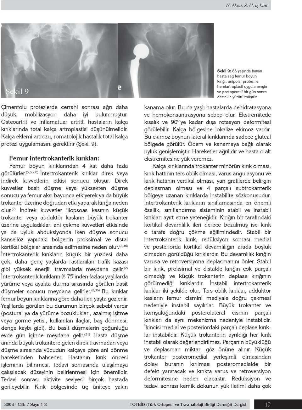 Kalça eklemi artrozu, romatolojik hastalık total kalça protezi uygulamasını gerektirir (Şekil 9). Femur intertrokanterik kırıkları: Femur boyun kırıklarından 4 kat daha fazla görülürler.