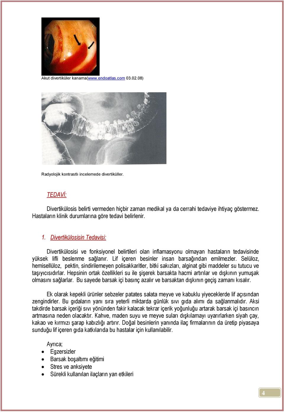 Divertikülosisin Tedavisi: Divertikülosisi ve fonksiyonel belirtileri olan inflamasyonu olmayan hastaların tedavisinde yüksek lifli beslenme sağlanır. Lif içeren besinler insan barsağından emilmezler.