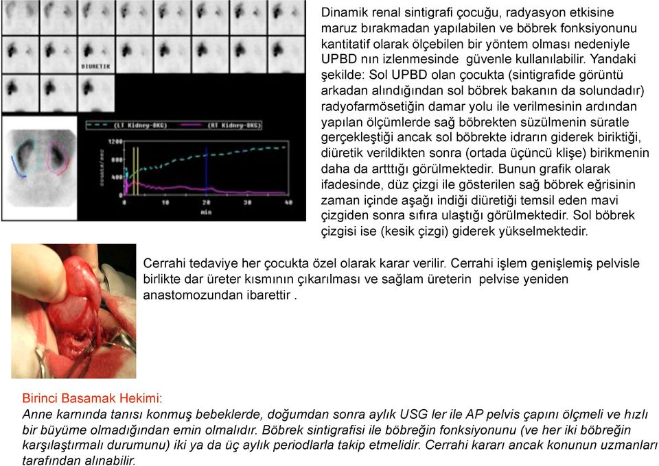 Yandaki şekilde: Sol UPBD olan çocukta (sintigrafide görüntü arkadan alındığından sol böbrek bakanın da solundadır) radyofarmösetiğin damar yolu ile verilmesinin ardından yapılan ölçümlerde sağ