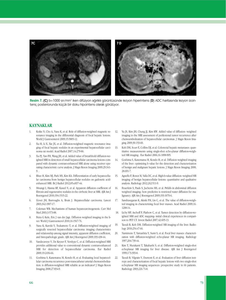 Diffusion-weighted magnetic resonance imaging of focal hepatic nodules in an experimental hepatocellular carcinoma rat model. Acad Radiol 2007;14:279-86. 3. Xu PJ, Yan FH, Wang JH, et al.