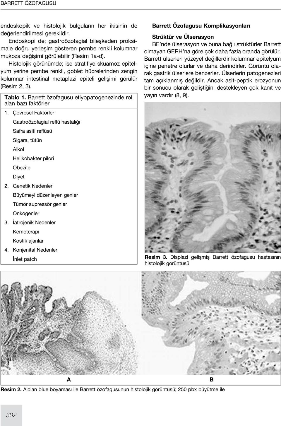 Histolojik görünümde; ise stratifiye skuamoz epitelyum yerine pembe renkli, goblet hücrelerinden zengin kolumnar intestinal metaplazi epiteli gelişimi görülür (Resim 2, 3). Tablo 1.
